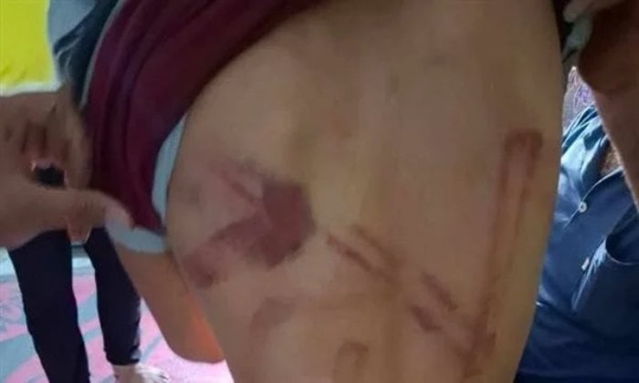 أب يعاقب طفله بالضرب بعد الطلاق: تحقيق في واقعة مؤلمة بالمنوفية