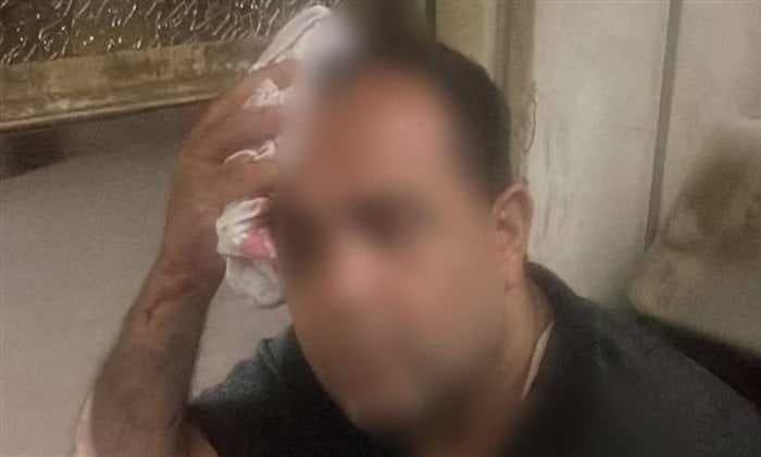 تحقيق في واقعة إصابة راكب بقطار جراء إلقاء الحجارة في المنوفية