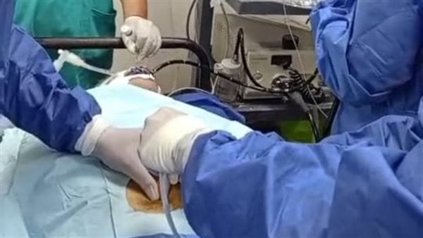 تطور طبي: علاج الجلطات بدون جراحة في مستشفى حميات منوف