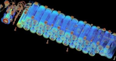 تحذيرات من الأشعة السينية حول المخاطر المخفية للبطاريات الرخيصة 5 تحذيرات من الأشعة السينية حول المخاطر المخفية للبطاريات الرخيصة